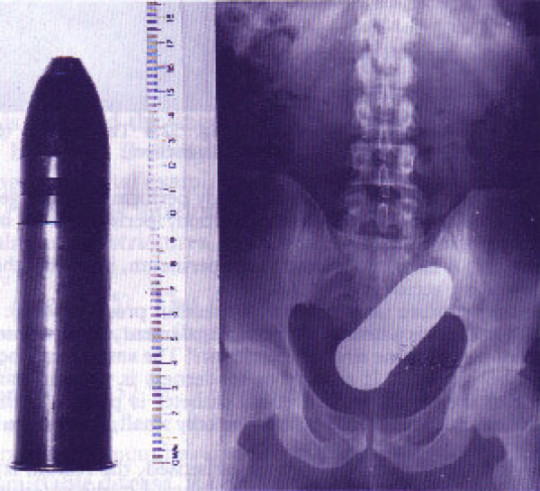 Radiografia Munizione